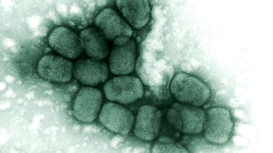 smallpox virus micrograph